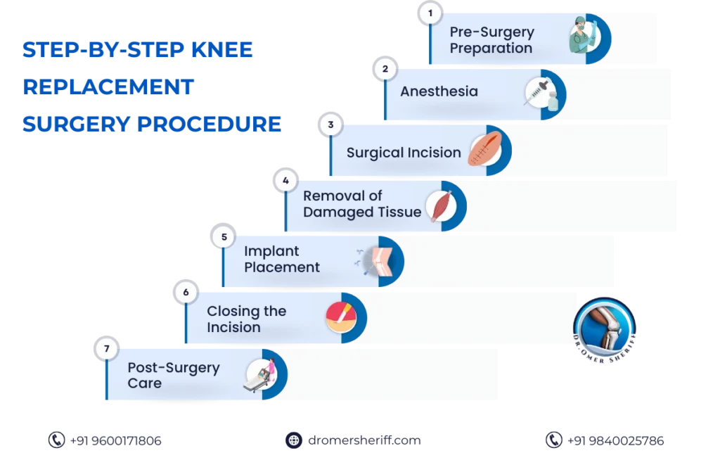 Best Knee Replacement Surgeon in India