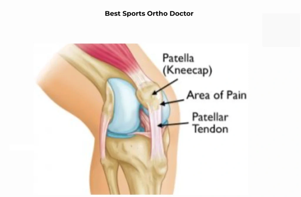 Best Sports Ortho Doctor in Chennai
