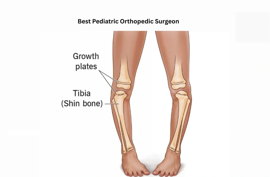 Best Pediatric Orthopedic Surgeon in Chennai