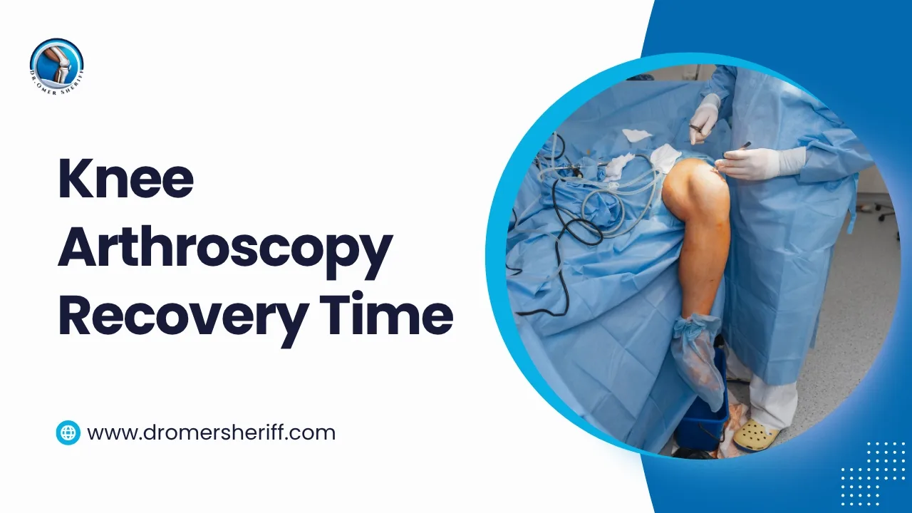 Knee Arthroscopy Recovery Time
