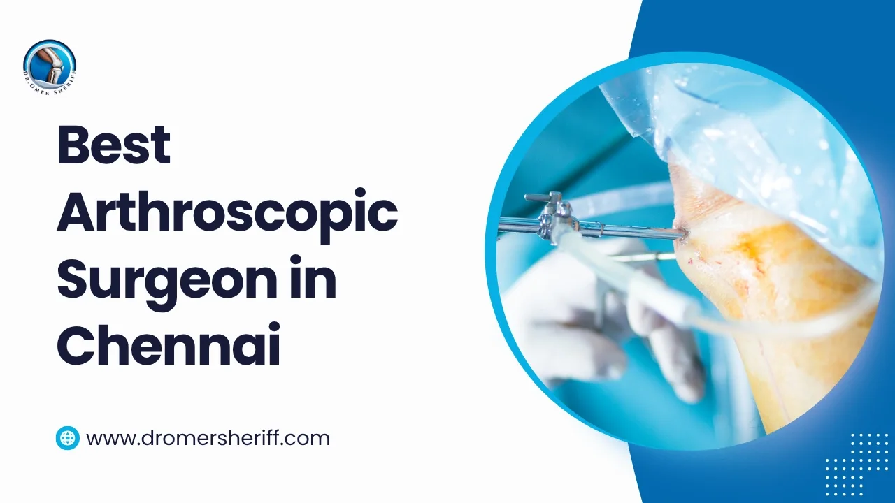 Best Arthroscopic Surgeon in Chennai