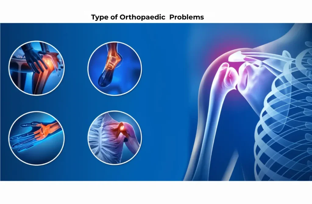 Best Orthopaedic Doctor in Chennai
