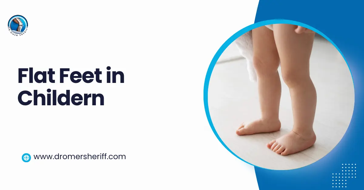 Flat Feet in Children