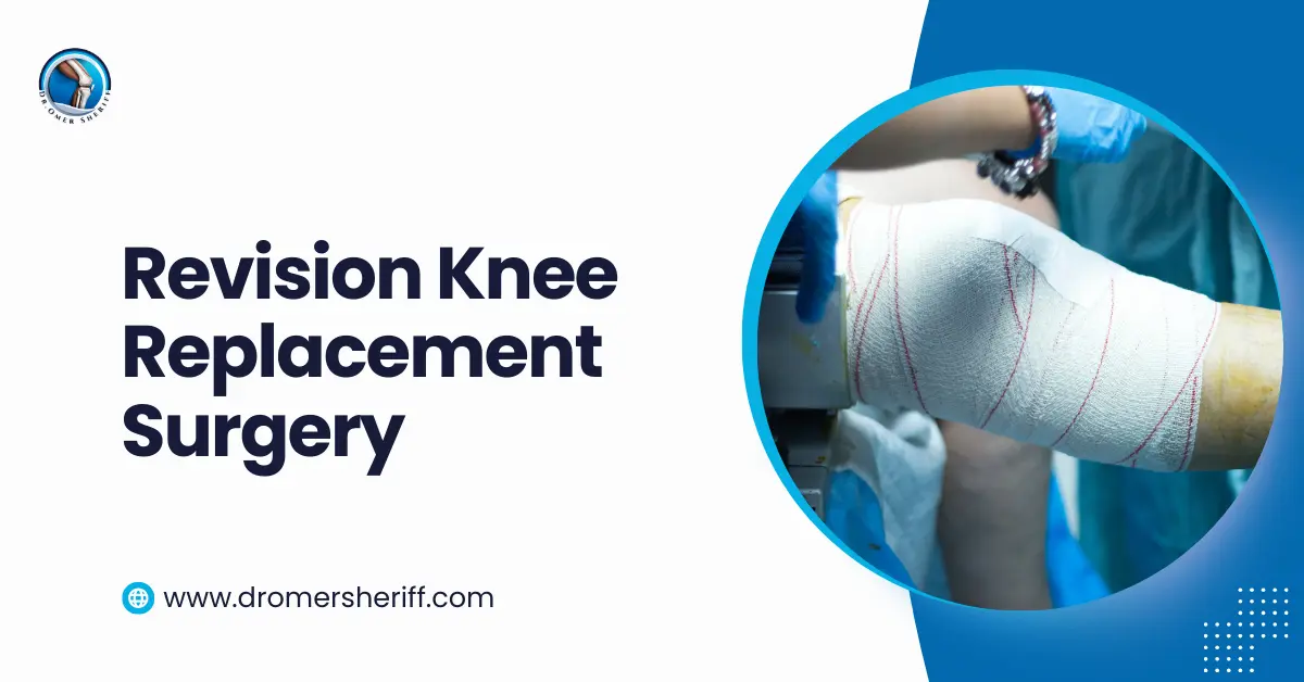Revision Knee Replacement Surgery