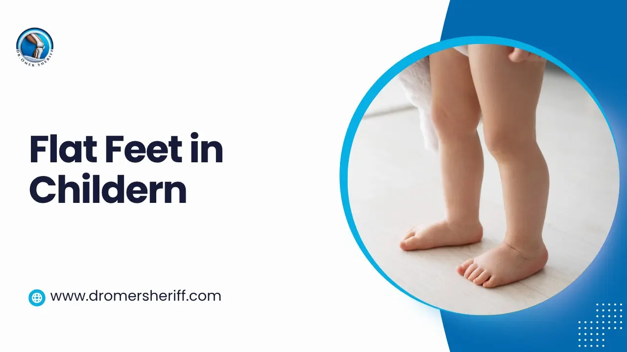 Flat Feet in Children