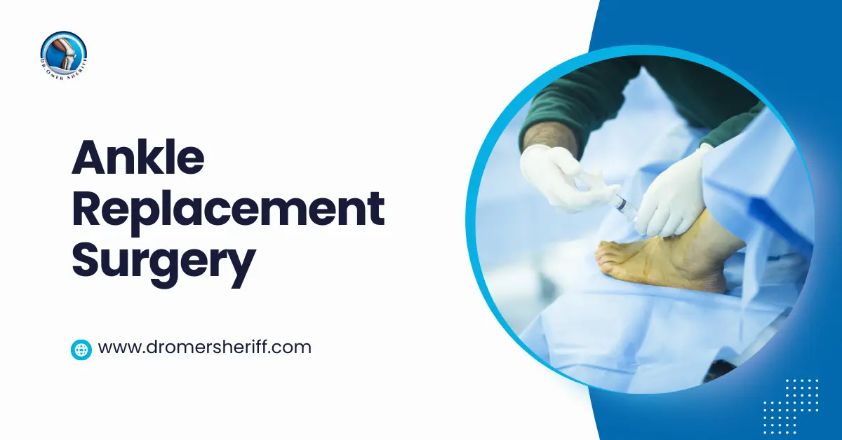 Ankle Replacement Surgery