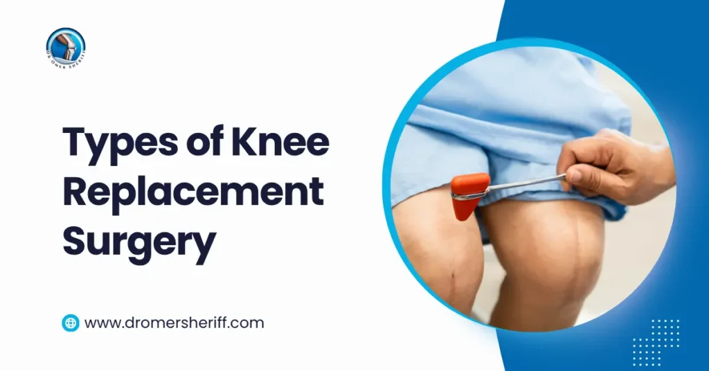Types of Knee Replacement Surgery