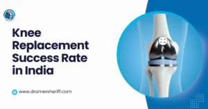 Knee Replacement Success Rate in India